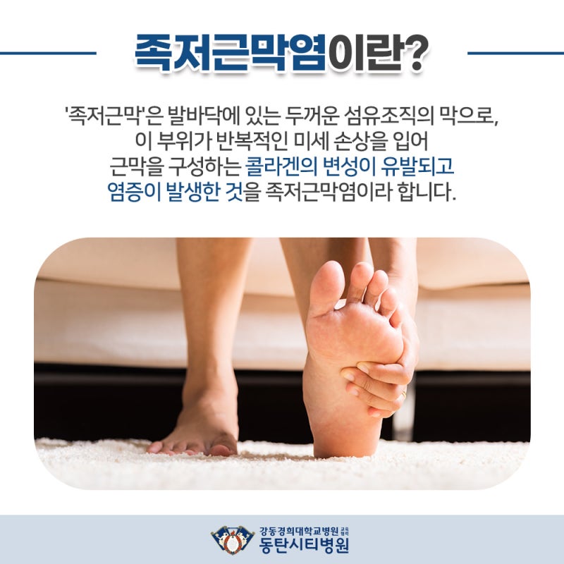 일상에 영향을 미치는 족저근막염의 특징
