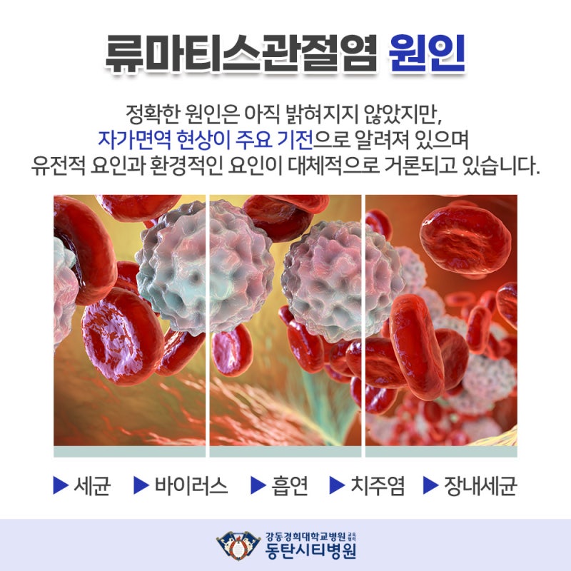 초기에 나타나는 증상과 경고 신호