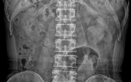 일반건강검진 대상자 기준