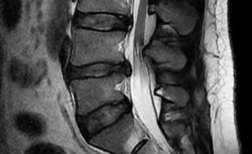 필요 시 고려되는 정밀 수술적 치료법