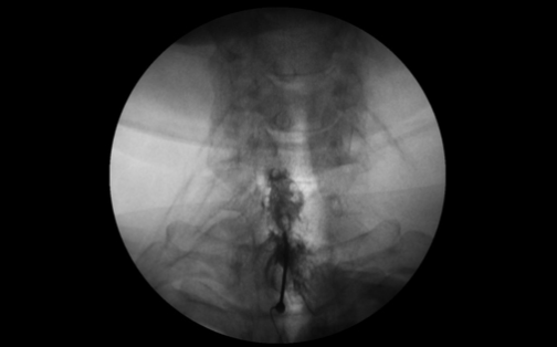 집에서도 도울 수 있는 간단한 허리 강화 운동
