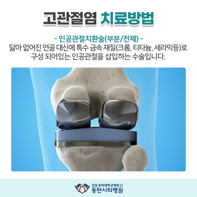 단계별 치료 접근법과 맞춤형 관리 시스템