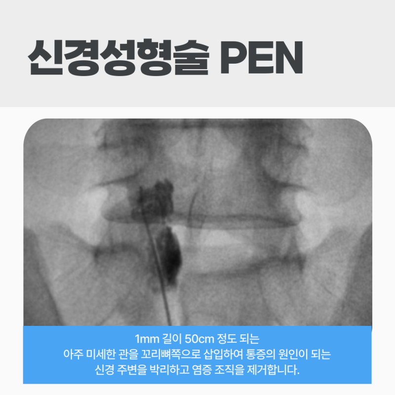 비수술로 한계일 때 고려하는 수술적 치료법