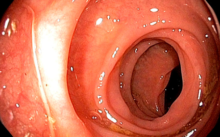 국가건강검진 제도와 일반검진 기준 알아보기