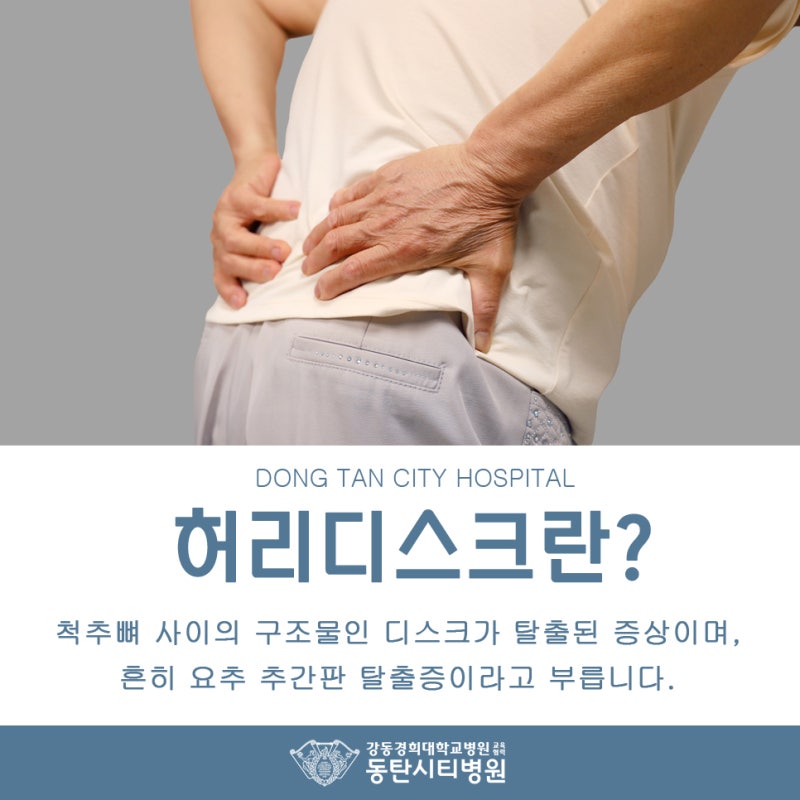 허리디스크의 구조적 원인과 증상 이해