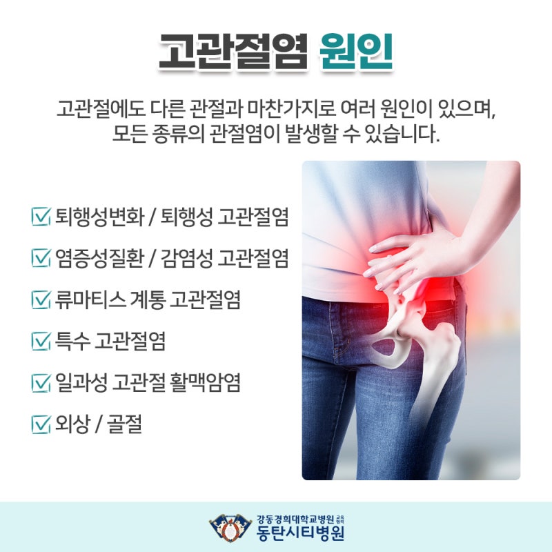 고관절염의 다양한 원인과 연령대별 발생 특징