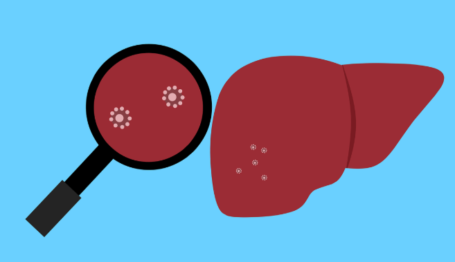 이런 증상이라면 꼭 검사 받아보세요