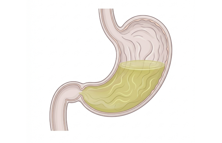 역류성 식도염 치료 병원별 관리법과 최신 치료방법 3 동탄 소화기내과에서 권장하는 생활습관 교정법