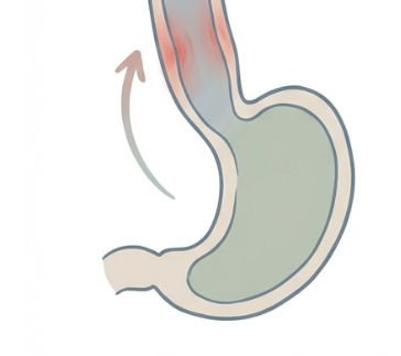 역류성 식도염 치료 병원별 관리법과 최신 치료방법 8 증상 지속 시 내시경 및 추가 치료 필요성