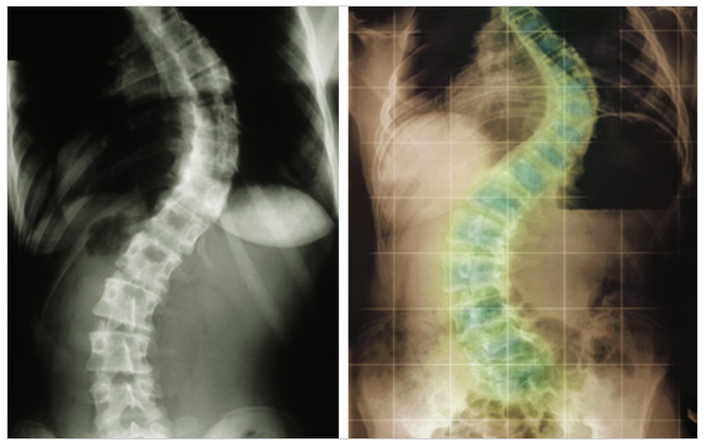 영통 척추병원에서 진행하는 비수술적 치료 접근