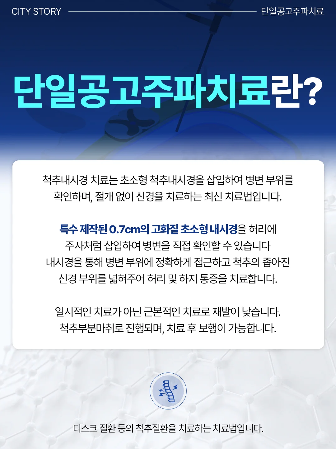 오산 CT병원|단일공고주파치료 및 척추내시경 치료법 설명 카드뉴스