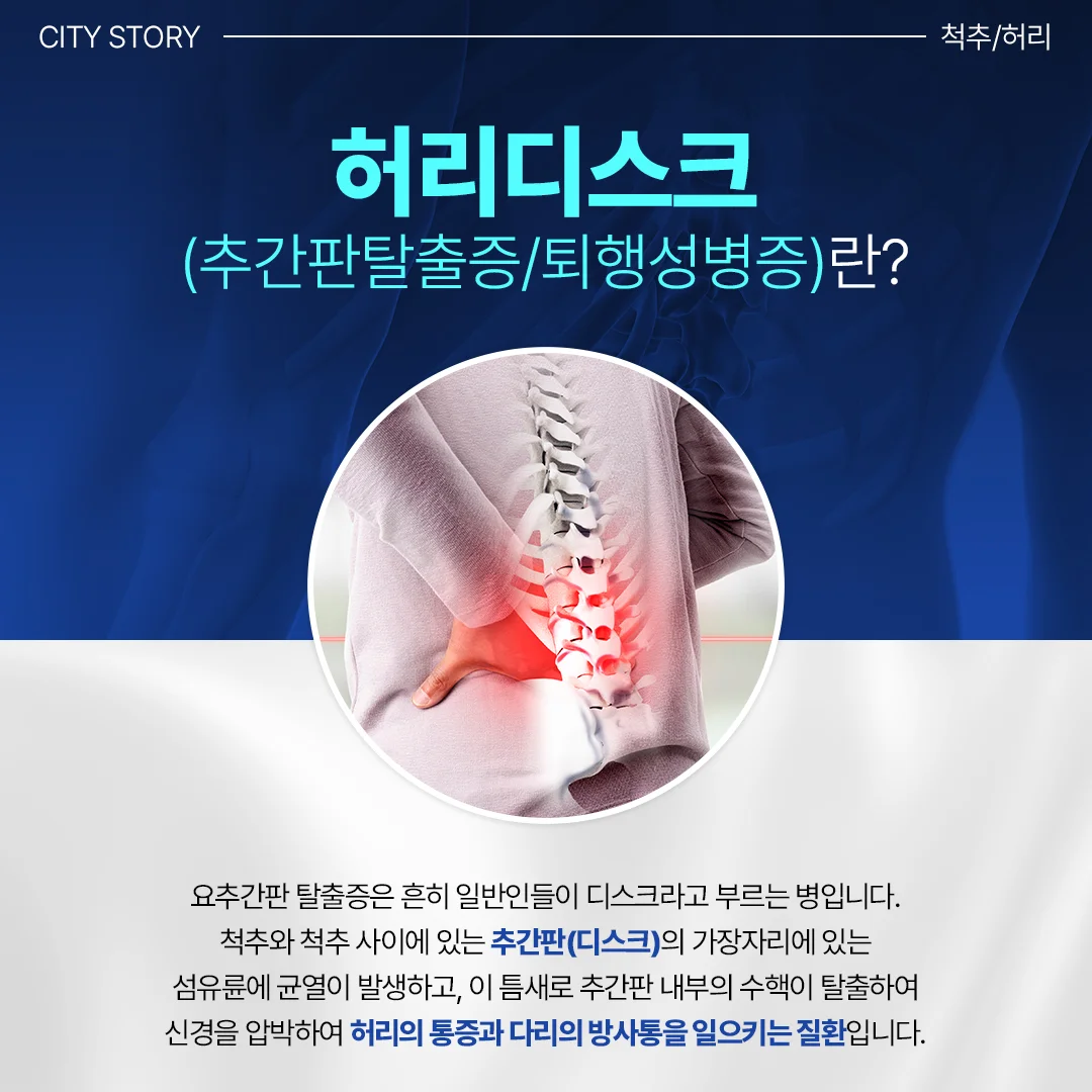 오산 CT병원|허리디스크(추간판탈출증)의 정의와 증상 설명 카드뉴스