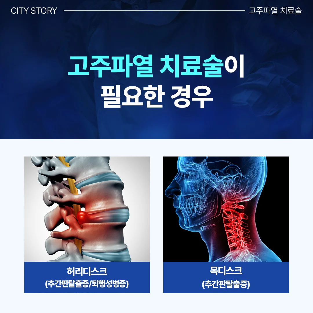 병점 허리디스크 비수술 치료|고주파열 치료술이 필요한 허리 및 목 디스크 증상 안내 카드뉴스