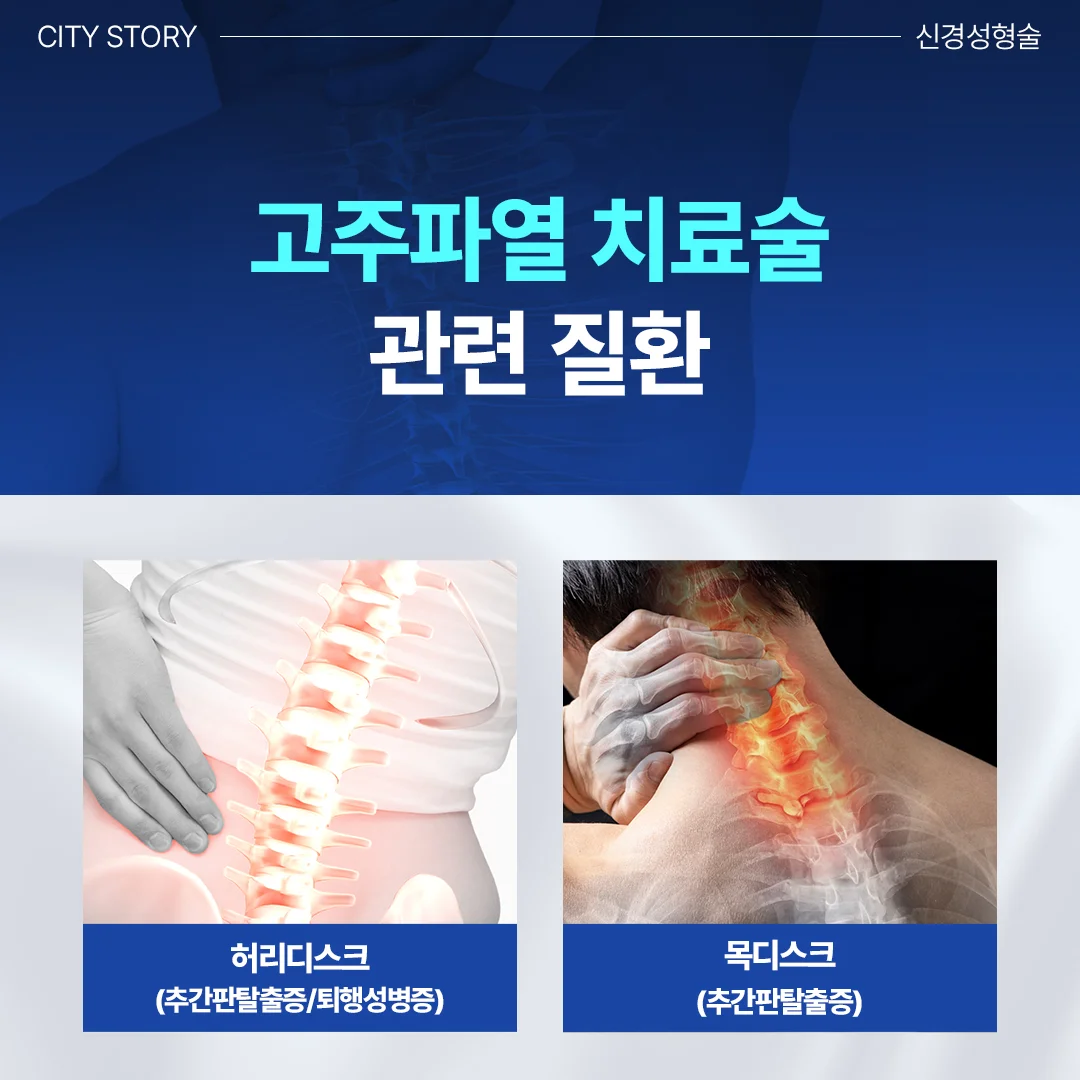 동탄 목디스크 도수치료|고주파열 치료술 관련 허리 및 목디스크 질환 안내