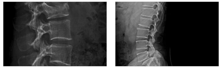 2026 04 1630746 cd25e376