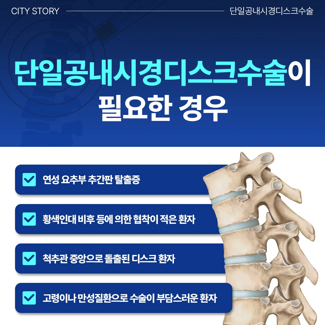 화성 척추내시경 후기|단일공 내시경 디스크 수술이 필요한 경우 안내 카드뉴스