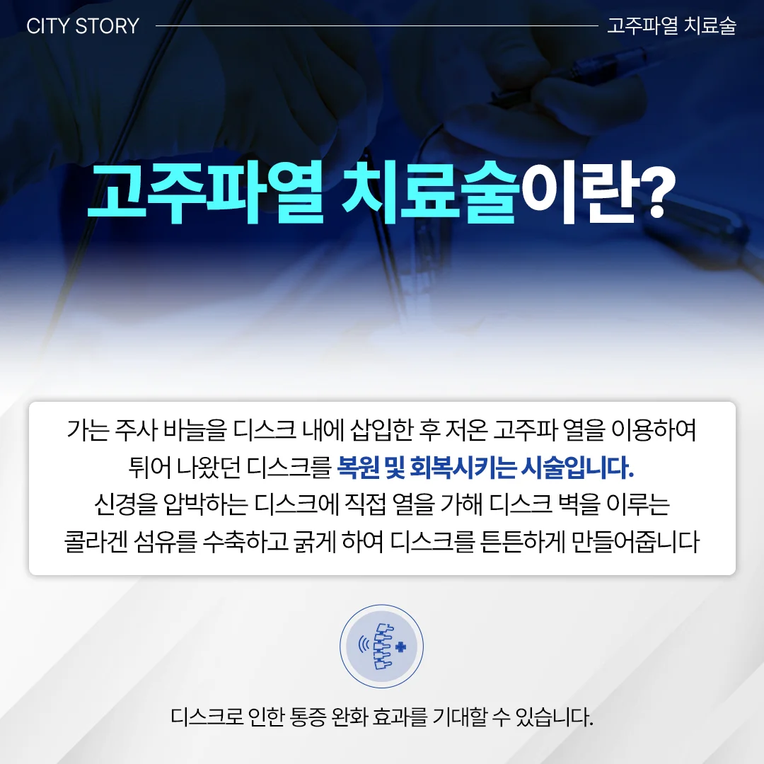 동탄 목디스크 도수치료|고주파열 치료술의 정의와 원리를 설명하는 의료 인포그래픽