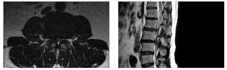 동탄 응급실 있는 병원, 응급진료 시 확인해야 할 사항 5 동탄 응급실 있는 병원|허리 MRI 영상